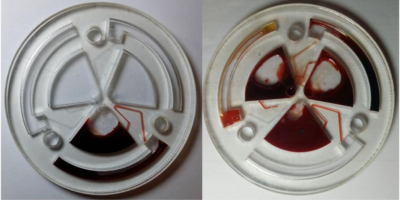 Microfluidics for Lab on a Chip Technology Microfluidics for Lab on a Chip Technology